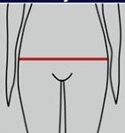 Hip Protectors